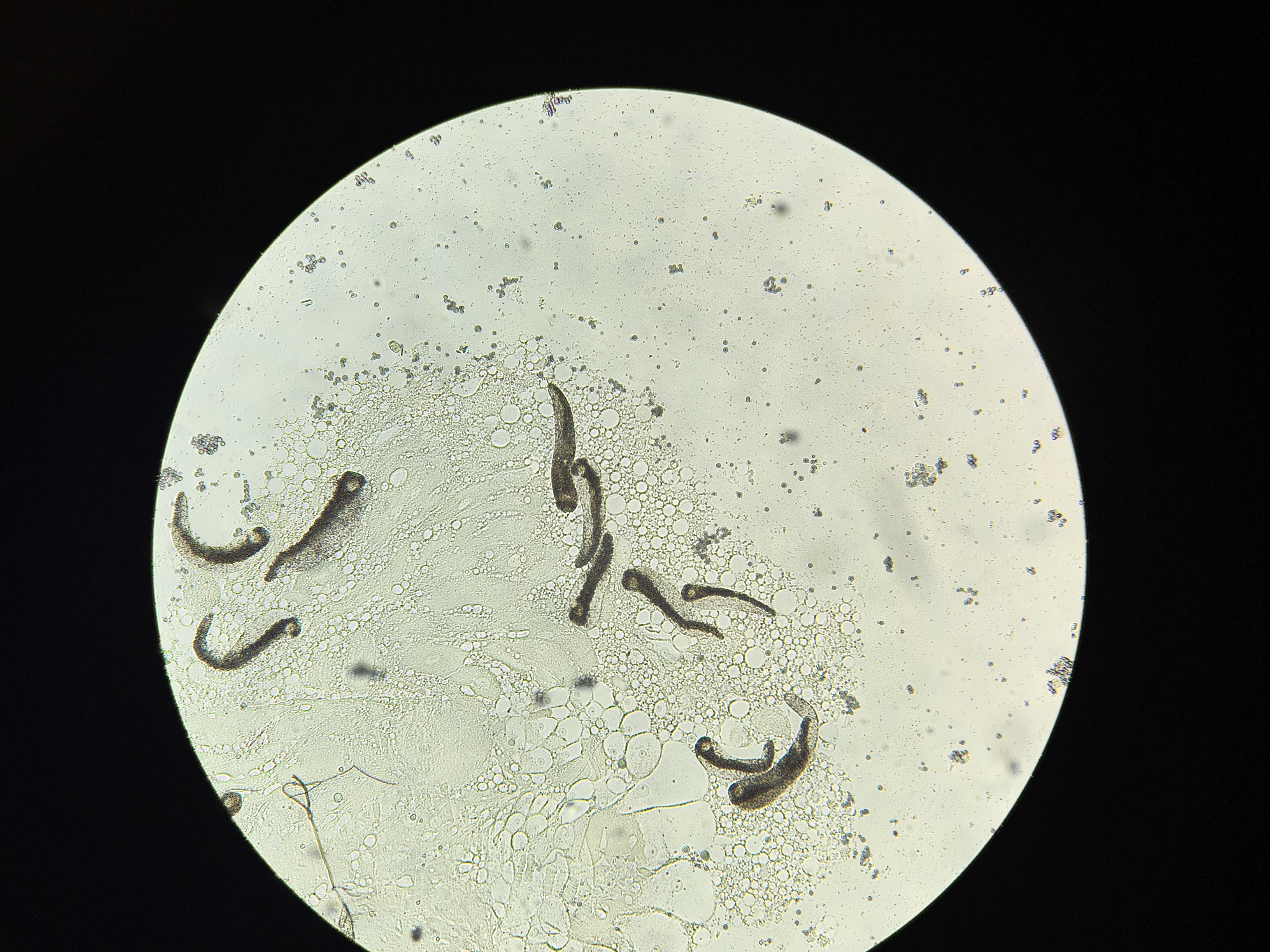 A microscopic image of Ascogregarina barretti trophozoites in the midgut tissue of a native North American Aedes triseriatus mosquito. Credit, E. Biro.